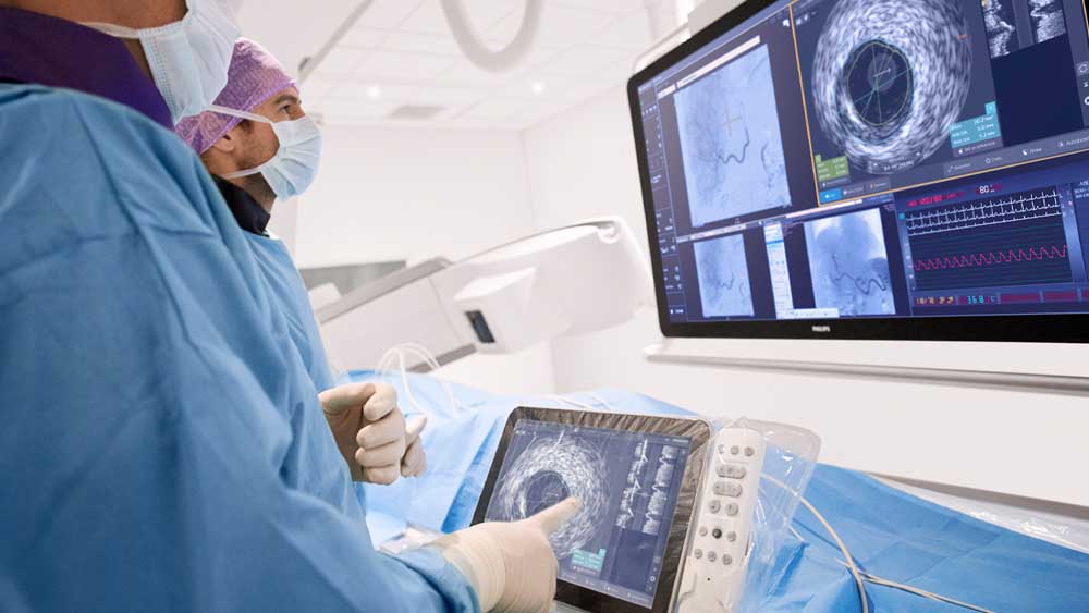 Ai e imaging intravascolare in Europa, dove si ridisegna la competizione medtech